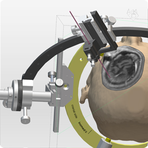 Proven iPS planning software for DBS and much more >>